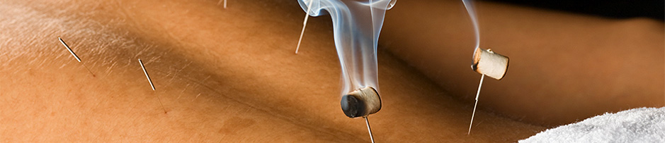 Acupuncture Services in Coolum and Noosaville