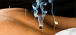 Acupuncture Therapy In Noosa
